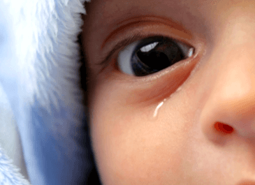 Ephiphora: What Causes Teary Eyes?