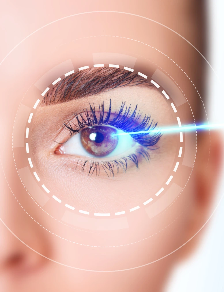 Brown eye with blue laser ray. Vision correction surgery.