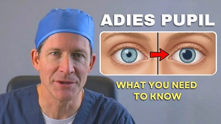 Adie's Pupil: Symptoms, Causes, and How It's Managed